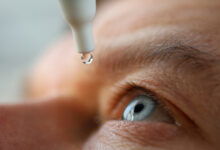 What is Fuchs Dystrophy | Fuchs Dystrophy | Is Fuchs' Dystrophy an Autoimmune Disease