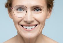 Laser Eye Surgery Myths | How Long Does Laser Eye Surgery Last | Does Laser Eye Surgery Hurt
